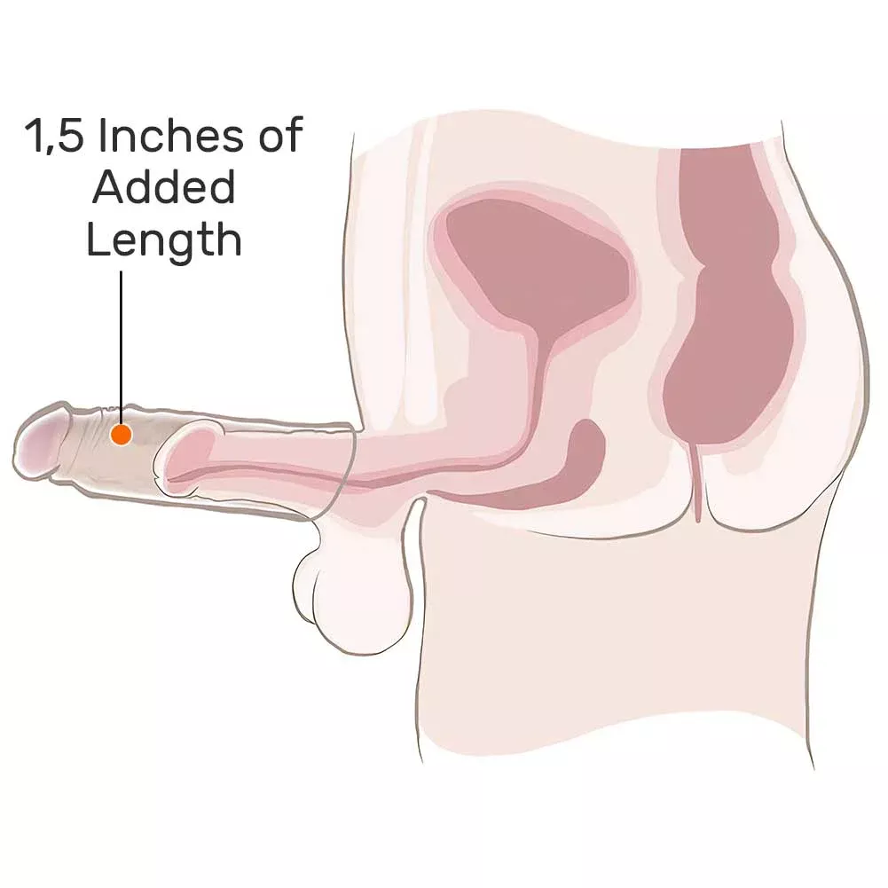 1.5" Extra Length Performance Penis Extension, 6.75", Vanilla